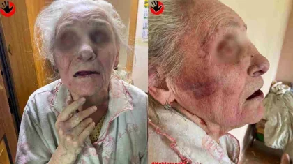 Алматыда баласы анасын әбден ұрып-соққан