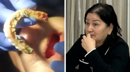 «Ұйқымнан тұрсам, имплант түсіп қалған»: Алматылықтар лицензиясы жоқ дәрігерден зардап шеккендерін айтты