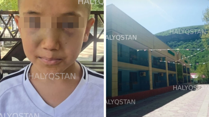 Түркістан облысындағы лагерьлердің бірінде 9 жастағы бала соққыға жығылған