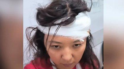 «Тірі қалмаймын ба деп қорықтым»: Таяқ жеген медбике оқиғаның мән-жайын айтты (ВИДЕО)