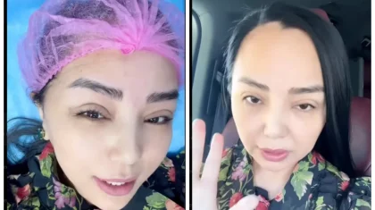 «Көзімді жіппен тіктірдім»: Алтынай Жорабаева блефаропластика жасап тұратынын мойындады