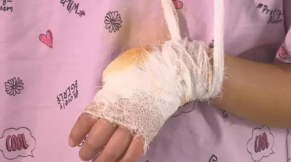 Ақтөбеде 5 жасар қыз аттракционнан жарақат алып, саусағынан айырылды