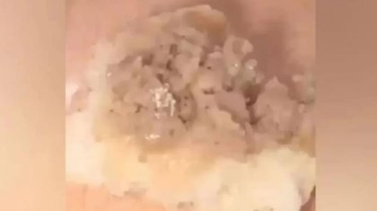 Жетісуда мектеп асханасындағы самсадан ақ құрттар шықты