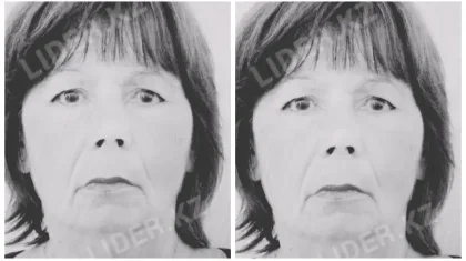 Петропавлда ауруханаға бет алған  зейнеткер аязға шыдамай үсіп қайтыс болды