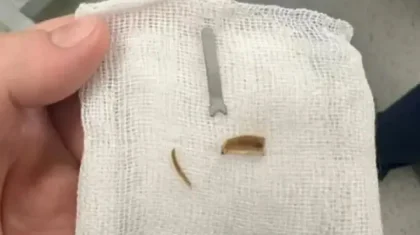 Ақтауда 11 айлық сәбидің өкпесінен металл табылды