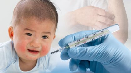 Қызылша індеті: балалар арасында қайталанып өрши бастады