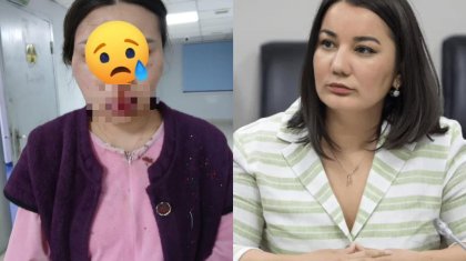 «Мереке күні күйеуі аяусыз ұрған»: Айгүл Орынбек сұмдық оқиғаны бөлісті (ФОТО)