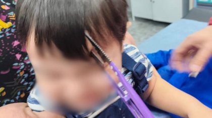 Жағдайы ауыр: Алматыда баланың басына қайшы кіріп кеткен