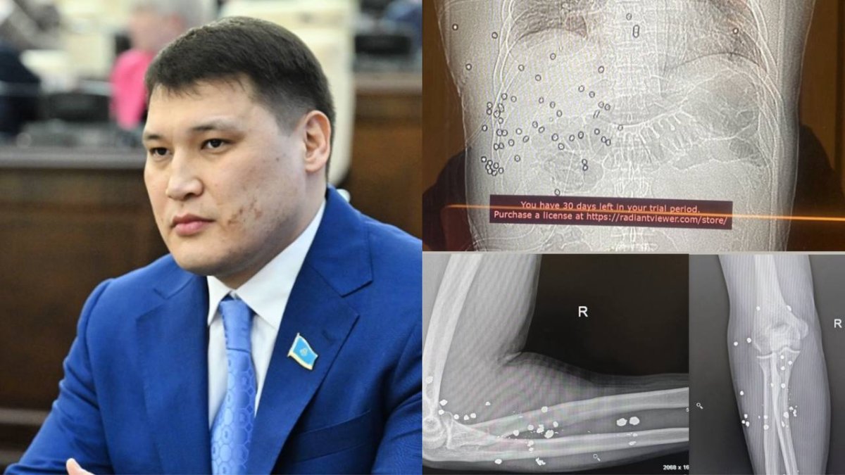 Коллаж: sn.kz