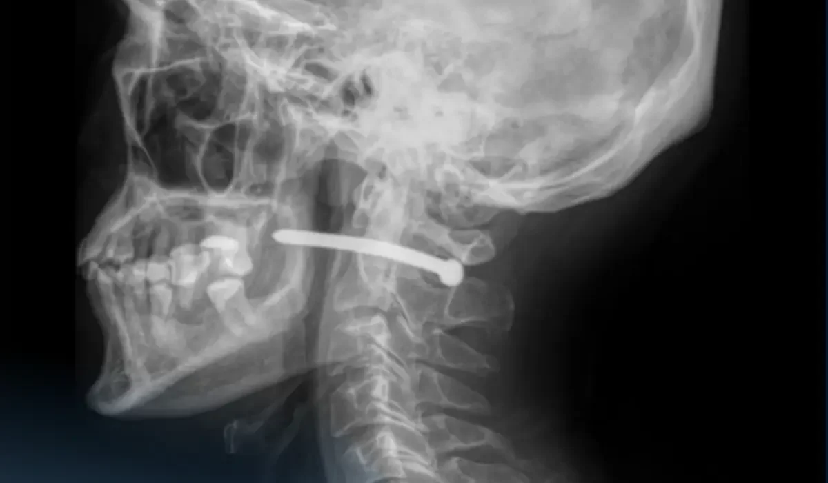Фото: Көп бейінді қалалық жедел медициналық жәрдем ауруханасы